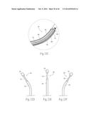 MULTI-DIRECTIONAL DEFLECTABLE CATHETER APPARATUSES, SYSTEMS, AND METHODS     FOR RENAL NEUROMODULATION diagram and image