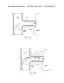 MULTI-DIRECTIONAL DEFLECTABLE CATHETER APPARATUSES, SYSTEMS, AND METHODS     FOR RENAL NEUROMODULATION diagram and image
