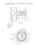 MULTI-DIRECTIONAL DEFLECTABLE CATHETER APPARATUSES, SYSTEMS, AND METHODS     FOR RENAL NEUROMODULATION diagram and image