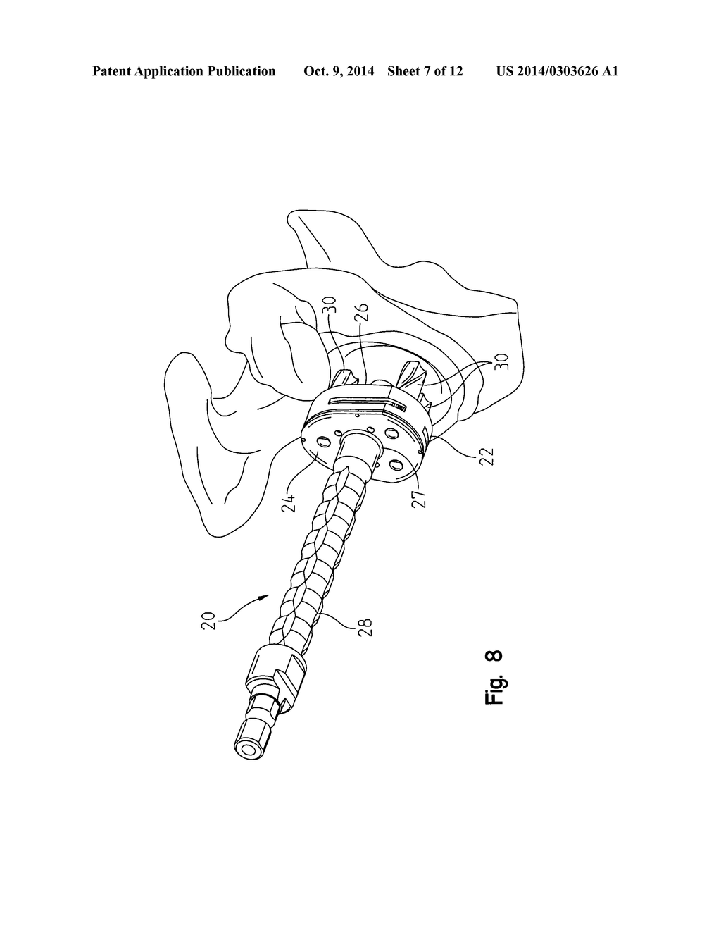 Peripheral Peg Drill Component - diagram, schematic, and image 08