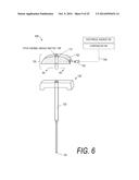 BONE TREATMENT SYSTEMS AND METHODS diagram and image