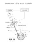 BONE TREATMENT SYSTEMS AND METHODS diagram and image