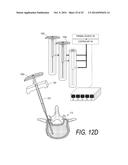 BONE TREATMENT SYSTEMS AND METHODS diagram and image