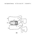 Expandable Fusion Device and Method of Installation Thereof diagram and image