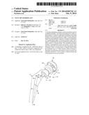 TOTAL HIP ARTHROPLASTY diagram and image