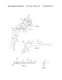 TOTAL HIP ARTHROPLASTY diagram and image