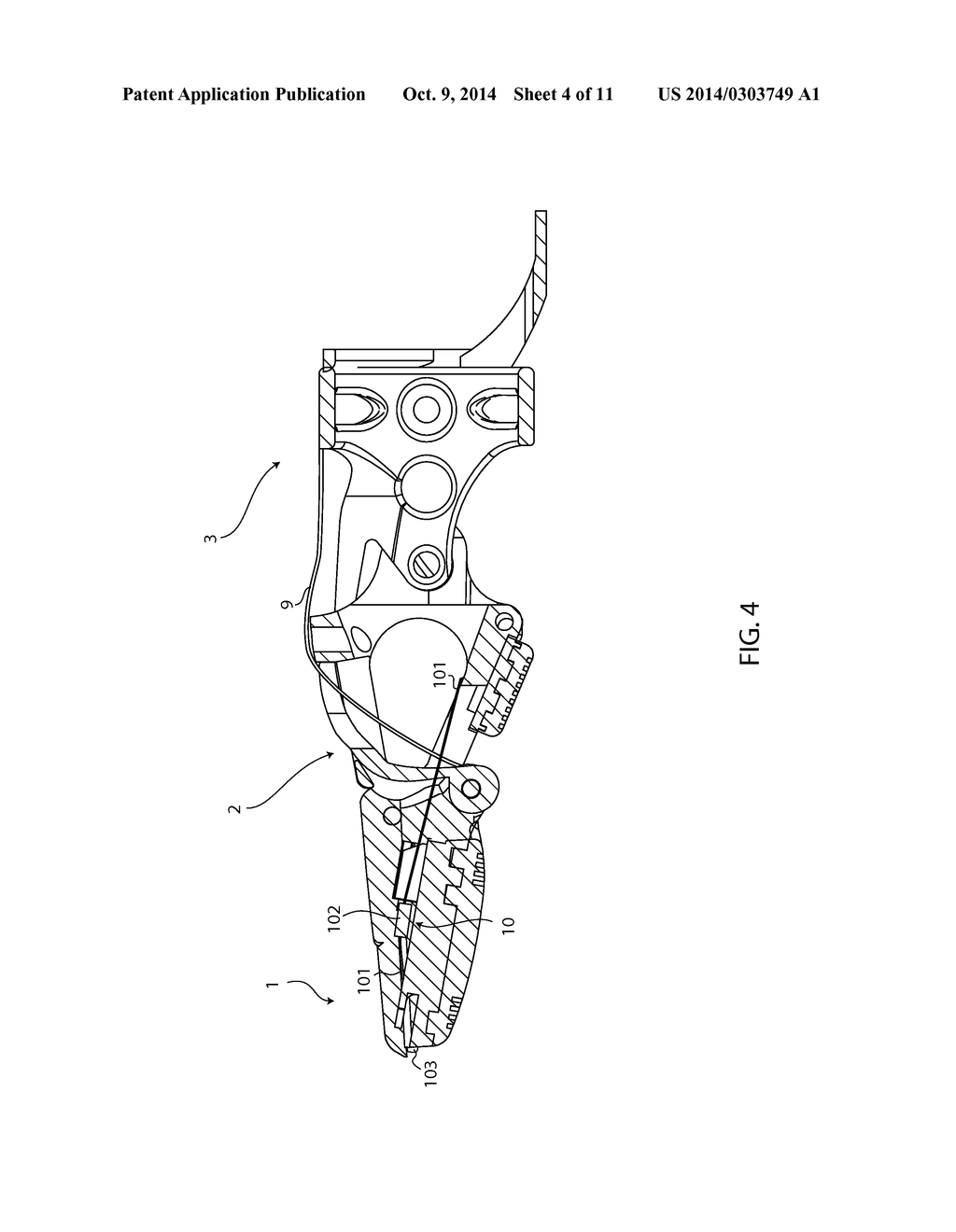 BIO-MECHANICAL PROSTHETIC FULL FINGER - diagram, schematic, and image 05