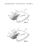 RETICULATED MATERIAL BODY SUPPORT AND METHOD diagram and image