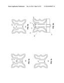 TREE GUARD AND ANCHORING SYSTEM diagram and image