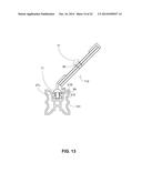 TREE GUARD AND ANCHORING SYSTEM diagram and image