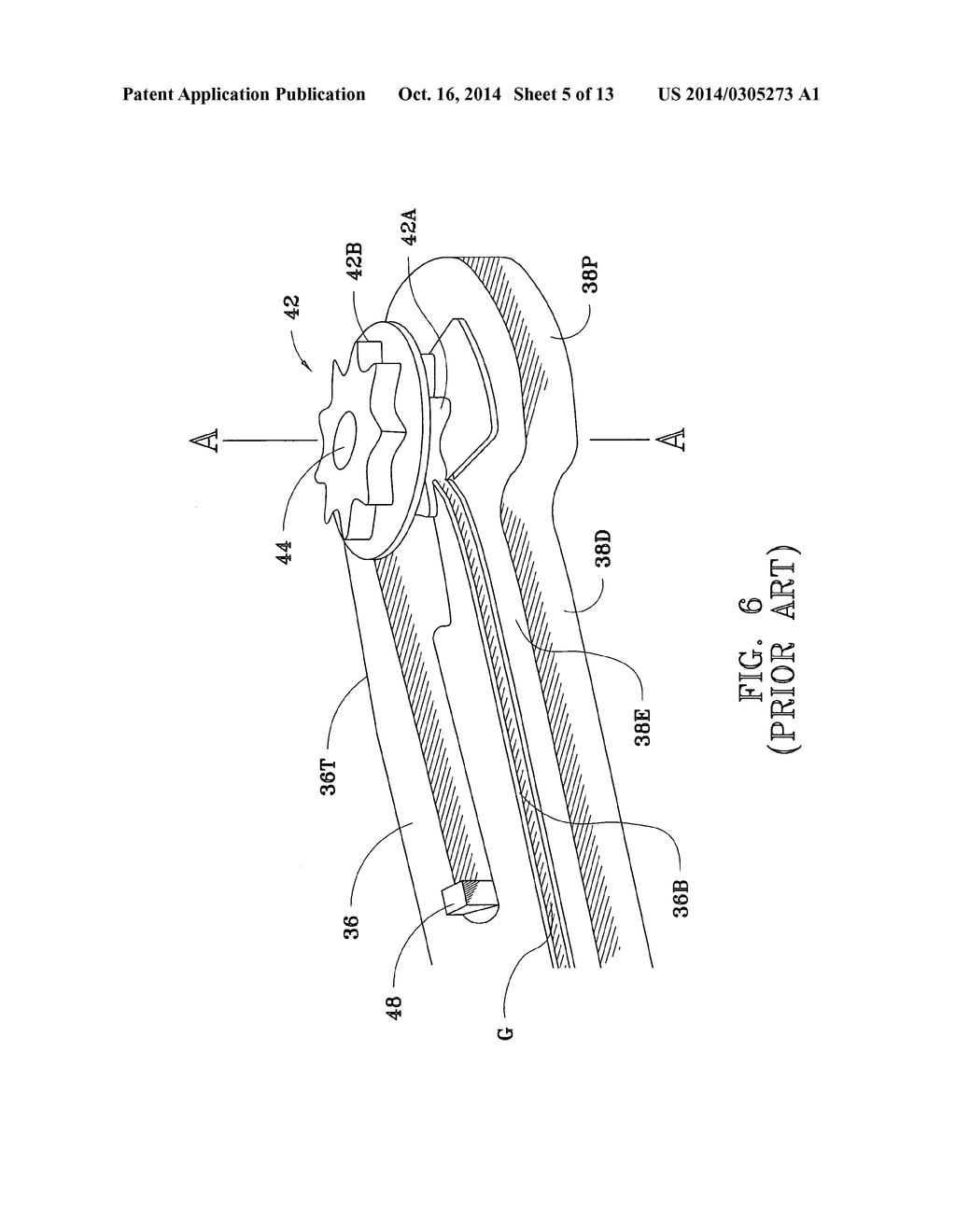 Chain saw chain containment device - diagram, schematic, and image 06