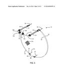 TELESCOPING FLUID PORTING TUBE diagram and image