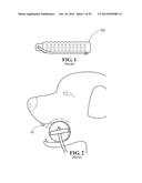 BREATHABLE RETRIEVING DEVICE diagram and image