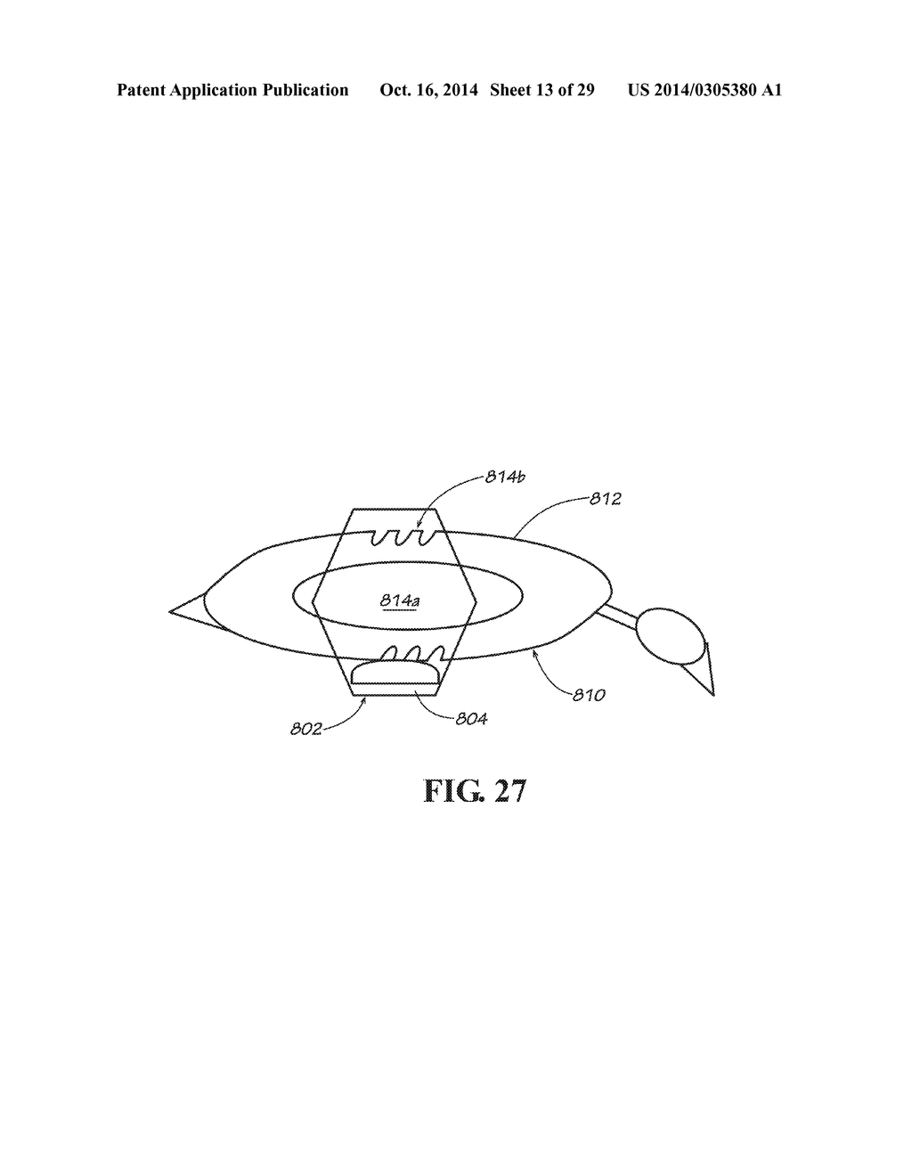 BREATHABLE RETRIEVING DEVICE - diagram, schematic, and image 14