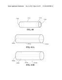 BREATHABLE RETRIEVING DEVICE diagram and image