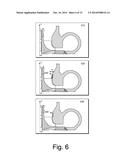 ADJUSTABLE COMPRESSOR TRIM diagram and image