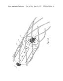 Long Reach Spindle Drive Systems and Method diagram and image