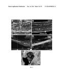 Methods for Use of Neural Stem Cell Compositions for Treatment of Central     Nervous System Lesions diagram and image