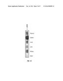 EXTRACELLULAR HISTONES AS BIOMARKERS FOR PROGNOSIS AND MOLECULAR TARGETS     FOR THERAPY diagram and image