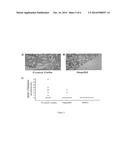 Stem Cell Fusion Model of Carcinogenesis diagram and image