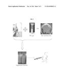 INJECTABLE SILK FIBROIN PARTICLES AND USES THEREOF diagram and image