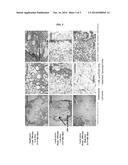 INJECTABLE SILK FIBROIN PARTICLES AND USES THEREOF diagram and image