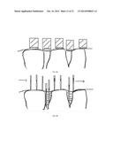 COMPUTER FABRICATION OF DENTAL PROSTHETICS diagram and image