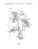 DENTAL ASPIRATION DEVICE AND METHOD OF USE diagram and image