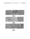 METAL MATERIALS HAVING A SURFACE LAYER OF CALCIUM PHOSPHATE, AND METHODS     FOR PREPARING SAME diagram and image