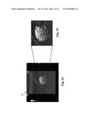 Ultrasound Phantom Models, Materials, and Methods diagram and image