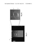 Ultrasound Phantom Models, Materials, and Methods diagram and image