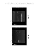 Ultrasound Phantom Models, Materials, and Methods diagram and image