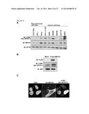 SMYD2 AS A TARGET GENE FOR CANCER THERAPY AND DIAGNOSIS diagram and image