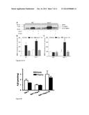 BIOMARKER FOR ABDOMINAL AORTIC ANEURYSM diagram and image