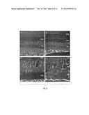 MARKERS RELATED TO AGE-RELATED MACULAR DEGENERATION AND USES THEREFOR diagram and image