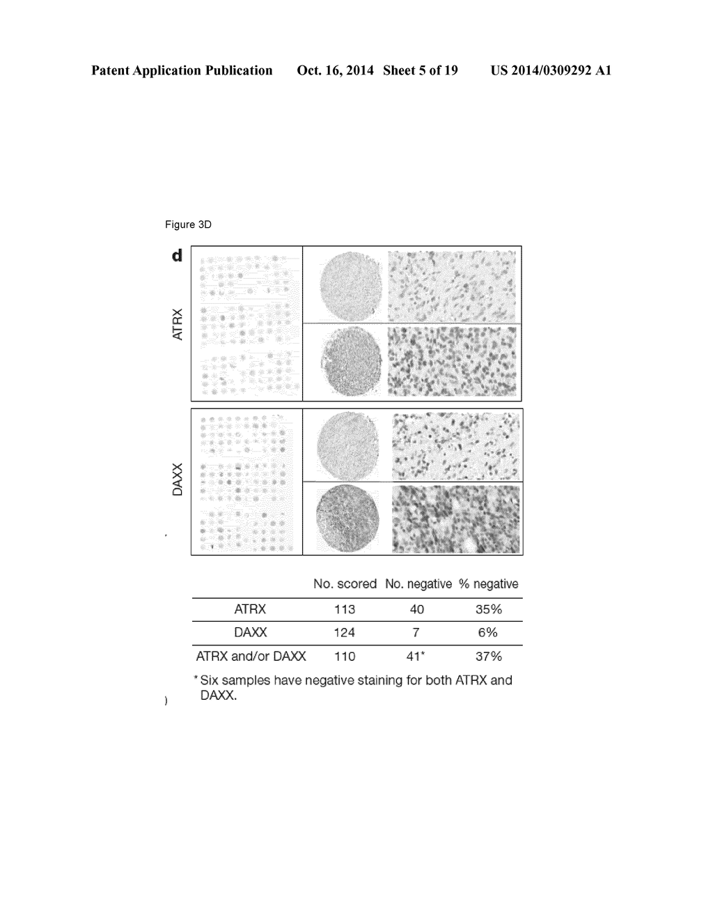 Mutations of Histone Proteins Associated with Proliferative Disorders - diagram, schematic, and image 06