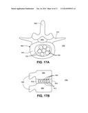 Carboxymethylcellulose Polyethylene Glycol Compositions for Medical Uses diagram and image