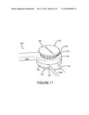 SELF-RETAINING RETRACTOR diagram and image