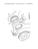 SELF-RETAINING RETRACTOR diagram and image