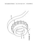 SELF-RETAINING RETRACTOR diagram and image