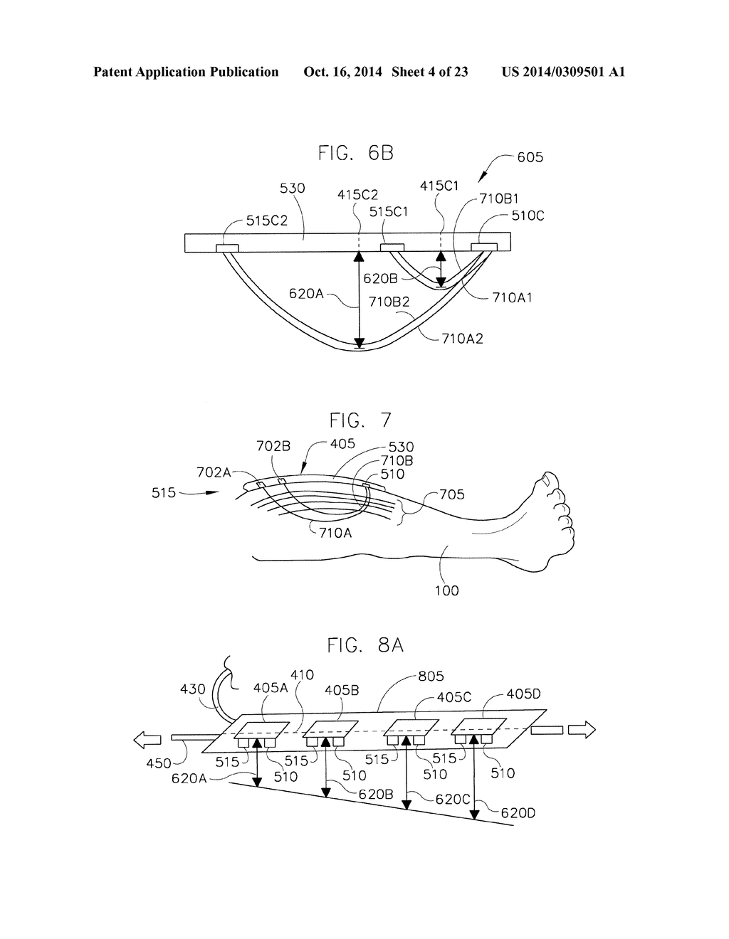 METHOD AND SYSTEM FOR MONITORING OXYGENATION LEVELS OF A COMPARTMENT FOR     DETECTING CONDITIONS OF A COMPARTMENT SYNDROME - diagram, schematic, and image 05