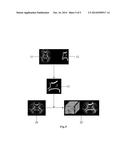 Method of Automatically Analyzing Brain Fiber Tracts Information diagram and image