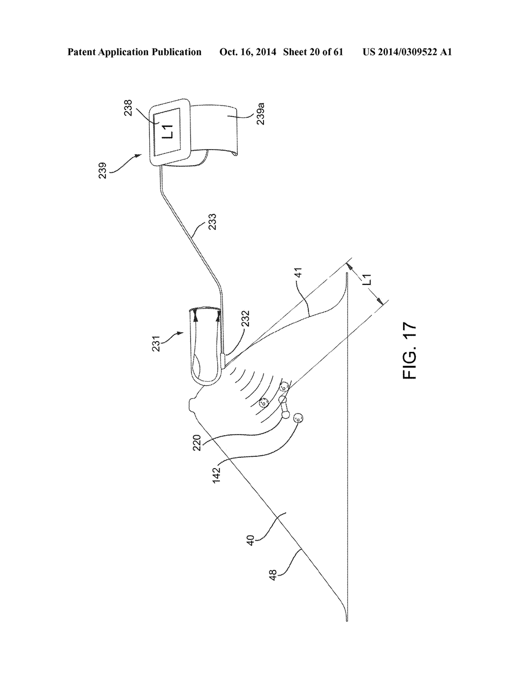 MICROWAVE ANTENNA APPARATUS, SYSTEMS, AND METHODS FOR LOCALIZING MARKERS     OR TISSUE STRUCTURES WITHIN A BODY - diagram, schematic, and image 21