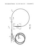 BALLOON CATHETER METHOD FOR REDUCING RESTENOSIS VIA IRREVERSIBLE     ELECTROPORATION diagram and image