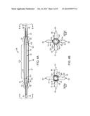 BALLOON CATHETER METHOD FOR REDUCING RESTENOSIS VIA IRREVERSIBLE     ELECTROPORATION diagram and image