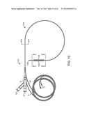 BALLOON CATHETER METHOD FOR REDUCING RESTENOSIS VIA IRREVERSIBLE     ELECTROPORATION diagram and image