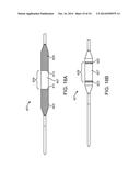 BALLOON CATHETER METHOD FOR REDUCING RESTENOSIS VIA IRREVERSIBLE     ELECTROPORATION diagram and image