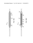 BALLOON CATHETER METHOD FOR REDUCING RESTENOSIS VIA IRREVERSIBLE     ELECTROPORATION diagram and image