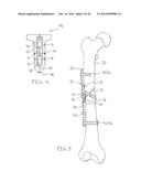 METHODS AND DEVICES FOR CONTROLLING BIOLOGIC MICROENVIRONMENTS diagram and image