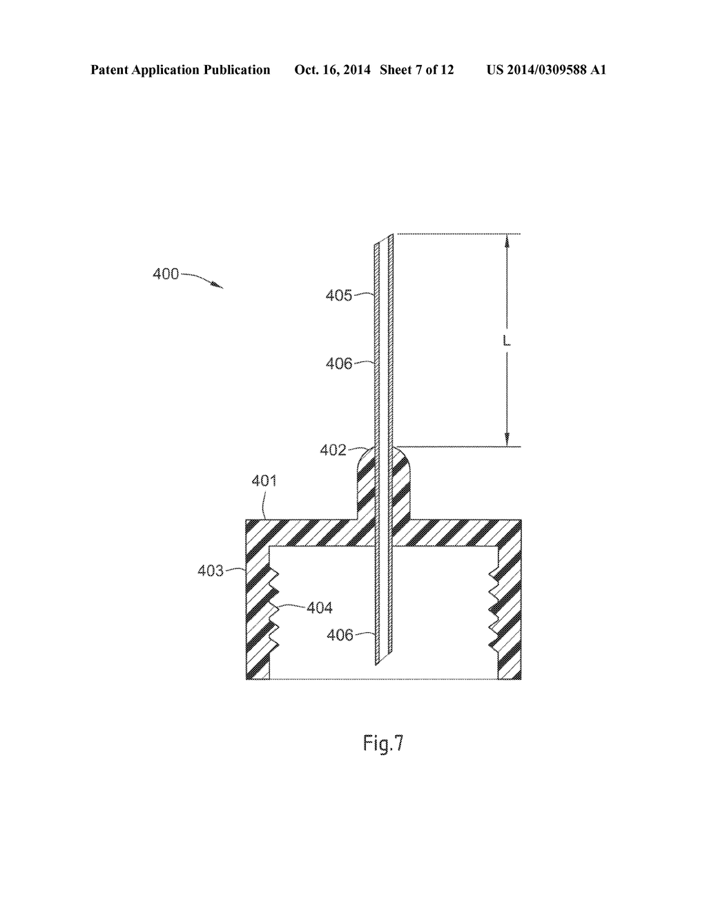 MEDICAL DEVICE AND METHOD FOR LIMITING THE USE OF THE MEDICAL DEVICE - diagram, schematic, and image 08